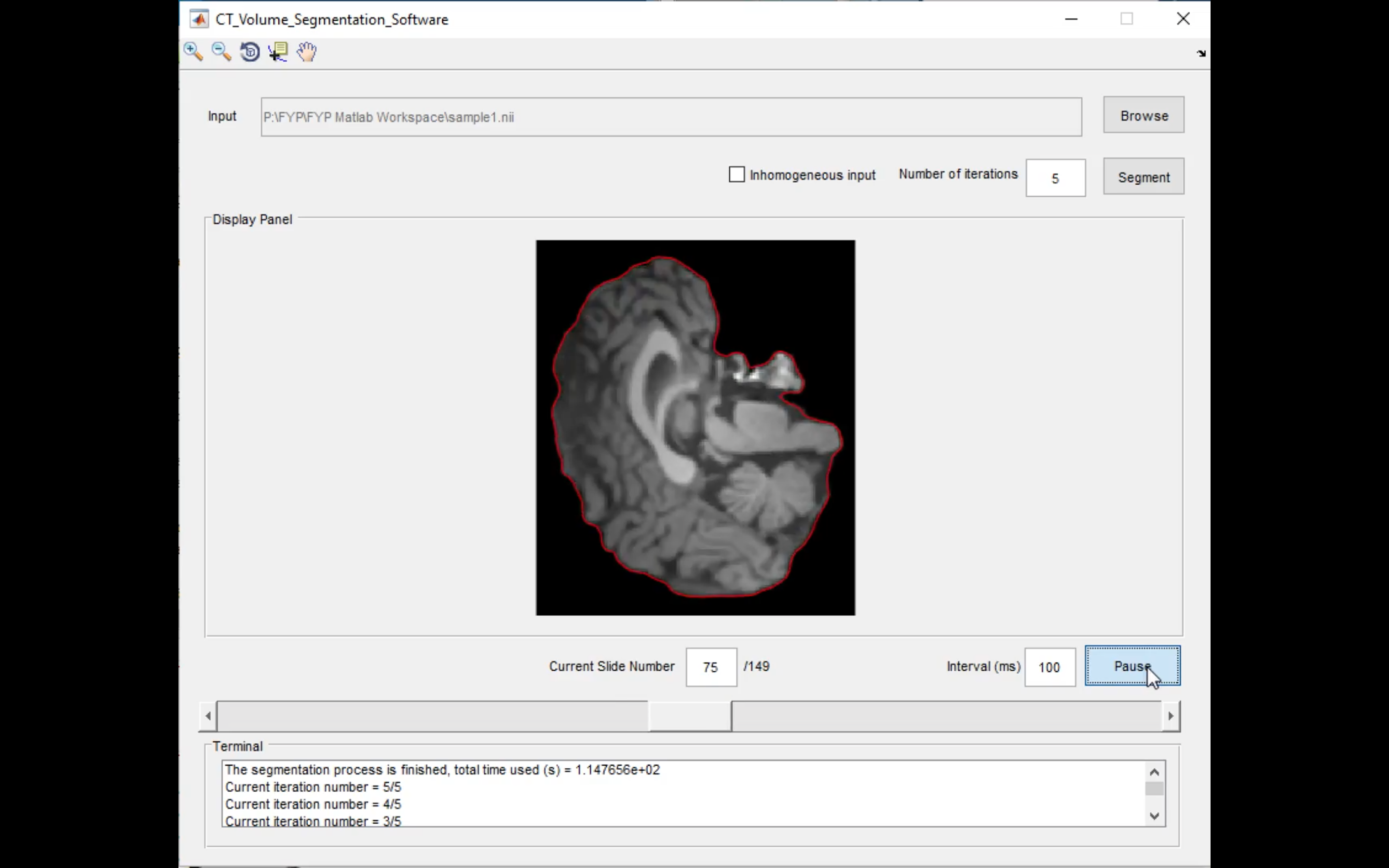 CT Segmentation Software